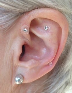 Swarovsky Bling and Ear Acupuncture – A Dazzling Approach to Better Health?